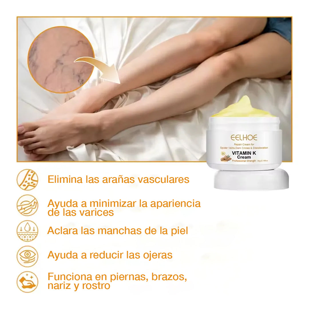Eelhoe™ Crema quita venitas al instante - con Vitamina K