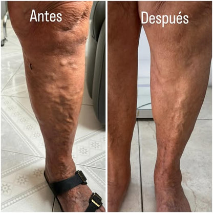 Alivra™ Calcetas de Compresión para Descansar tus Piernas