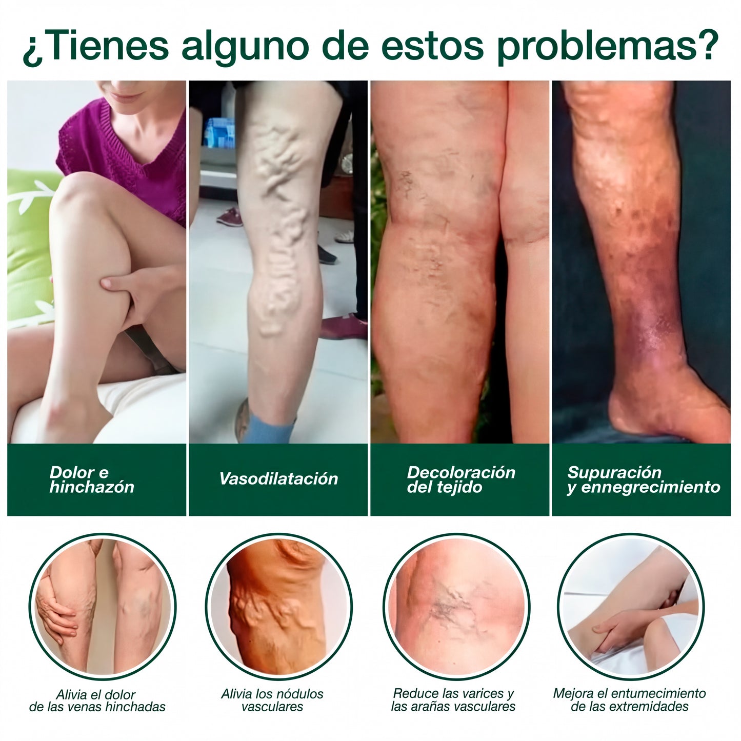 Alivra Adiós Varices, rápido y natural - Pomada Herbal