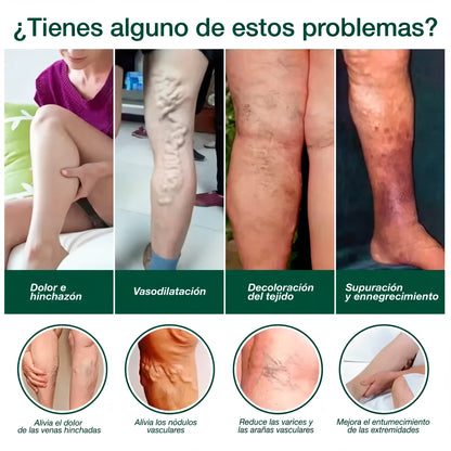 Alivra Adiós Varices, rápido y natural - Pomada Herbal