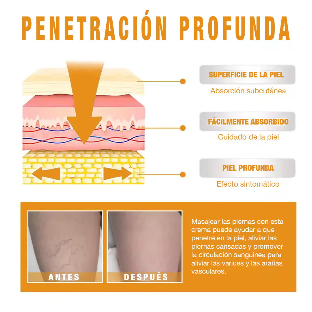 Eelhoe™ Crema quita venitas al instante - con Vitamina K