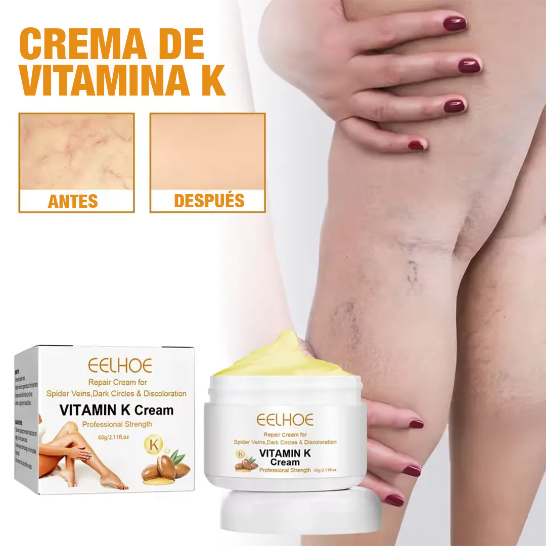 Eelhoe™ Crema quita venitas al instante - con Vitamina K