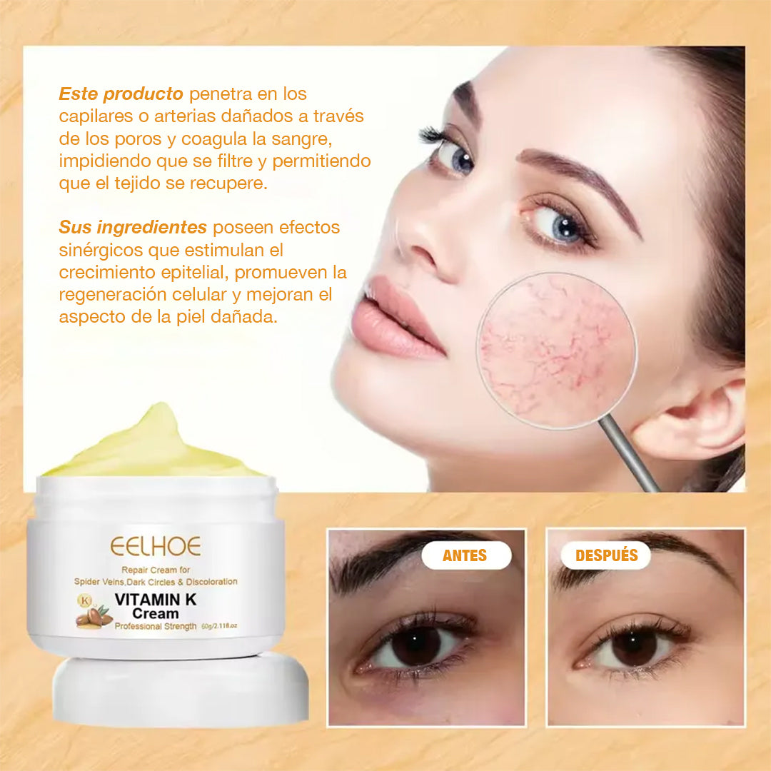 Eelhoe™ Crema quita venitas al instante - con Vitamina K