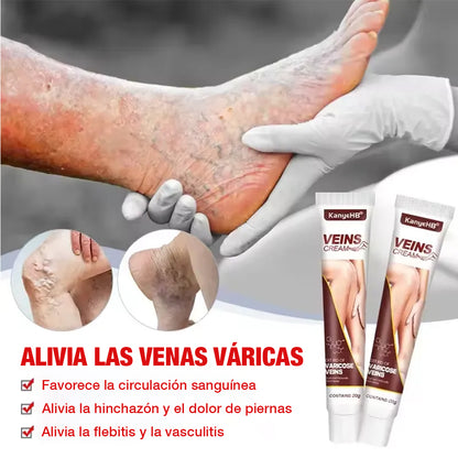 Kanye HB™ Adiós Varices, rápido y natural - Pomada Herbal