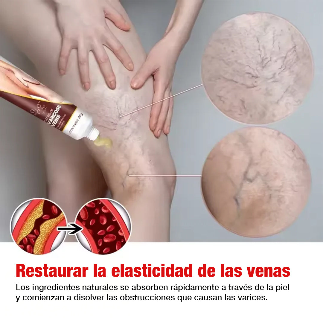 Kanye HB™ Adiós Varices, rápido y natural - Pomada Herbal